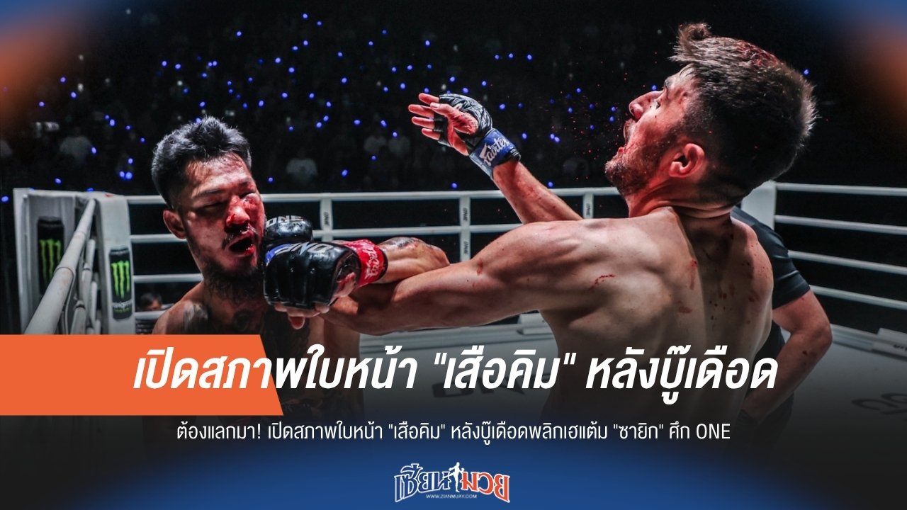 "เสือคิม" เปิดตัวสุดเดือด! ชนะใจแฟนมวย แม้ต้องแลกด้วยใบหน้าที่บอบช้ำในศึก ONE