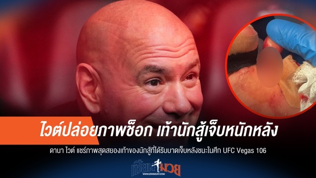 ไวต์ปล่อยภาพช็อก! เท้านักสู้เจ็บหนักหลังคว้าชัย UFC